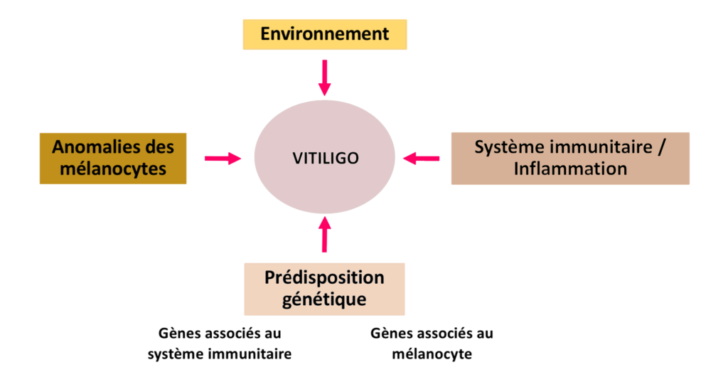 Vitiligo maladie multifactorielle