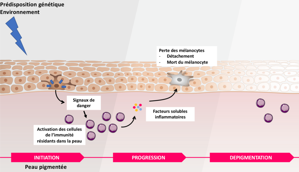 Mécanismes du vitiligo