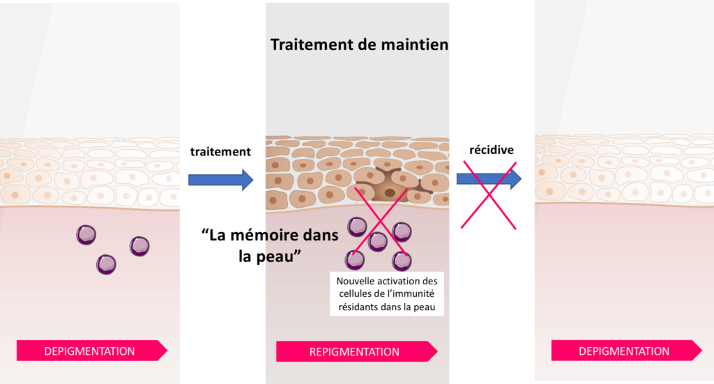 Traitement de maintien vitiligo repigmentation