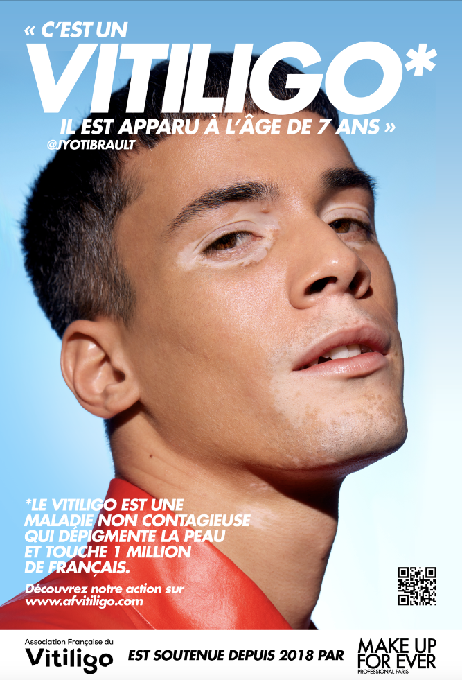 Affiche Make Up For Ever vitiligo Jyoti Brault