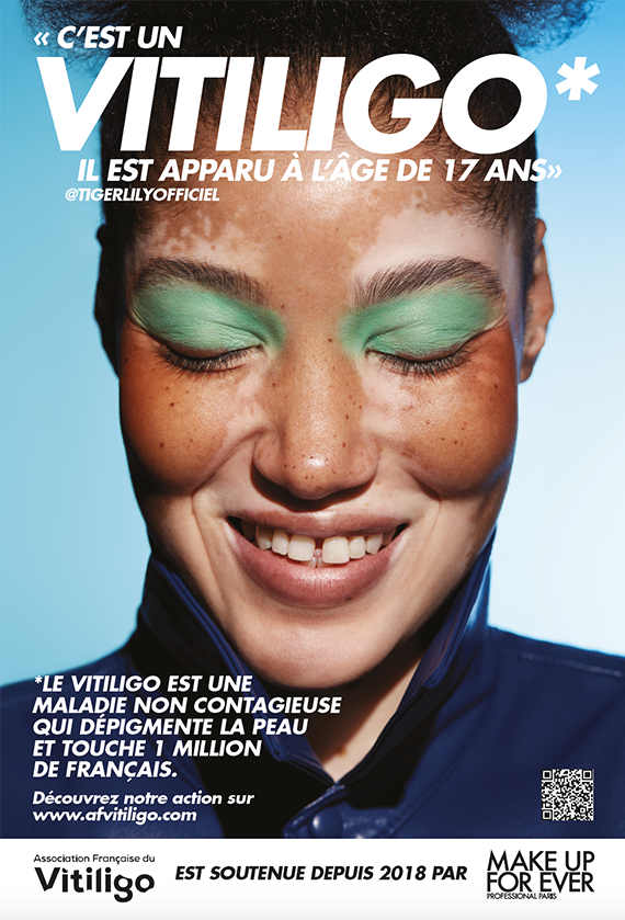 Affiche Make Up For Ever vitiligo Tiger Lily