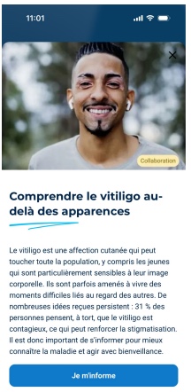Interstitiel Doctolib sur mobile : « Comprendre le vitiligo au-delà des apparences »